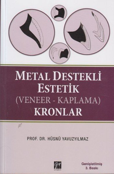 Gazi Kitabevi Metal Destekli Estetik Kronlar - Hüsnü Yavuzyılmaz Gazi Kitabevi Gazi Kitabevi Metal Destekli Estetik Kronlar - Hüsnü Yavuzyılmaz Gazi Kitabevi